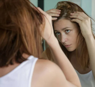 female hair loss help gold coast